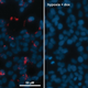 Izquierda: sin inhibidor. Derecha: con inhibidor. En rojo, la proteína HIF-1. Imágenes: Universidad de Southampton